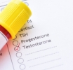 Peyronie’s Disease: Testosterone Levels Not Linked to Extent of Penis Curve